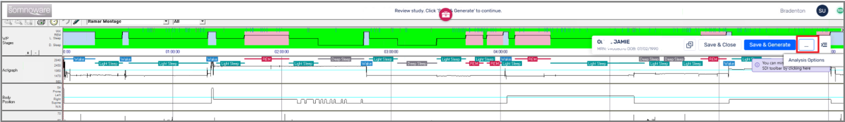 SW_Screenshot_SDI_DetectArrhythmiaFeature.png